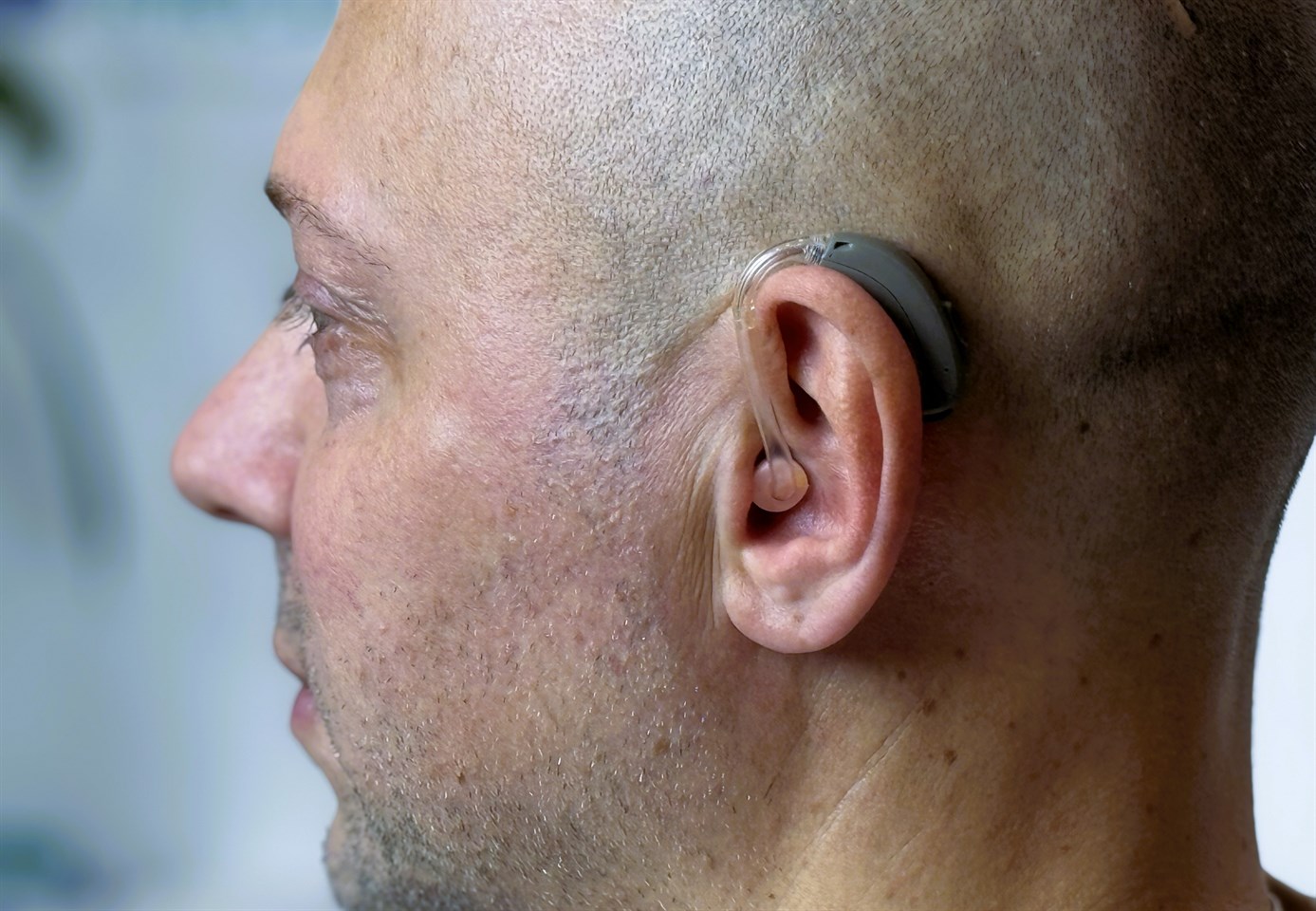 Слуховые аппараты